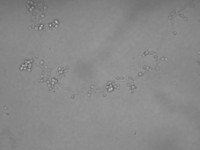Candida tropicalis-microculture on the modified agar Nickerson, after 154 h incubation.

