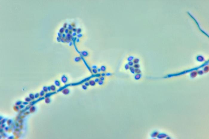 This photomicrograph reveals the conidiophores and conidia of the fungus Sporothrix schenckii. Sporotrichosis, caused by the etiologic pathogen Sporothrix schenckii, is a skin infection involving the subcutaneous layer, and manifest itself in the formation of large ulcerations, however, the disease can become systemically disseminated. Content Providers(s): CDC/Dr. Libero Ajello Creation Date: 1972 Copyright Restrictions: None - This image is in the public domain and thus free of any copyright restrictions. As a matter of courtesy we request that the content provider be credited and notified in any public or private usage of this image.