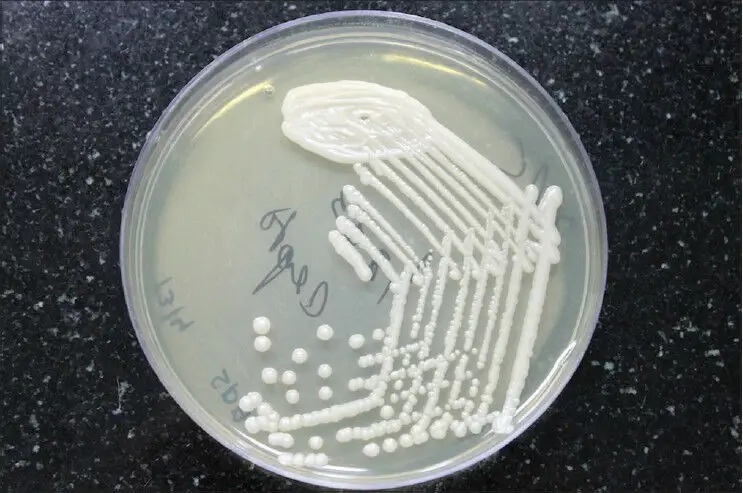 Cryptococcus colonies on Sabroud's dextrose agar medium
