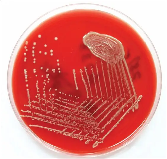 Cryptococcus colonies on blood agar medium

