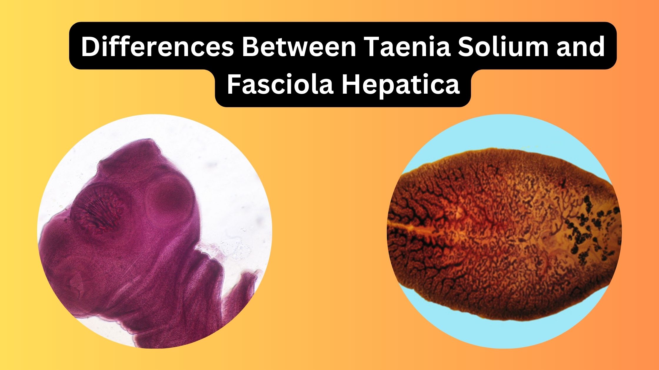Differences Between Taenia Solium and Fasciola Hepatica