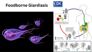 Foodborne Giardiasis - Definition, Pathogenesis, Contamination
