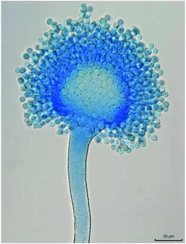 Light microscopy of Aspergillus flavus with lactophenol cotton blue. Photo: Vladimir Ostry.
