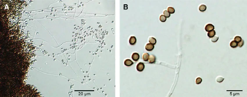 Microscopic morphology of Sporothrix globosa after 21 days of culture at 30°C in potato dextrose agar (CBS 132925 = Ss236). Hyaline, thin, septated hyphae and numerous globose, dark-brown sessile conidia are visible. (A) 20× and (B) 40× magnifications. 
