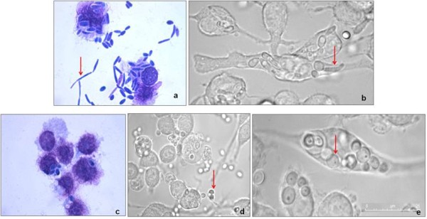 Microscopic observations of C. parapsilosis incubated with J774 macrophages. Hemacolor staining and bright field images of the co-incubation of macrophages with the clinical isolate 972697 (a and b) and the environmental isolate CarcC (c to e), after 12 hours. Arrows point to the different yeast morphologies in contact with macrophages.
