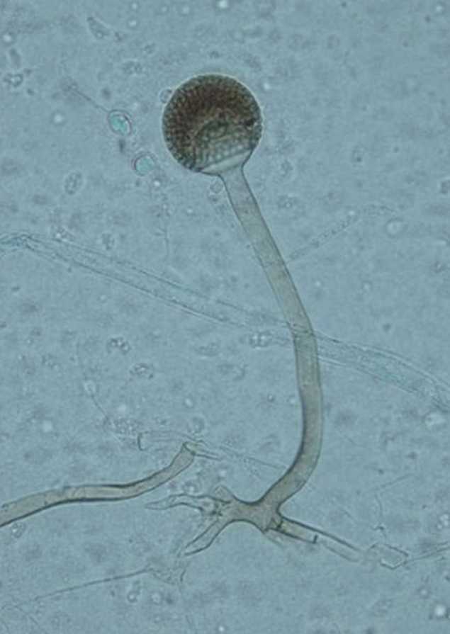 R. microspores (lactophenol cotton blue stain, ×400). (Kim, 2014)