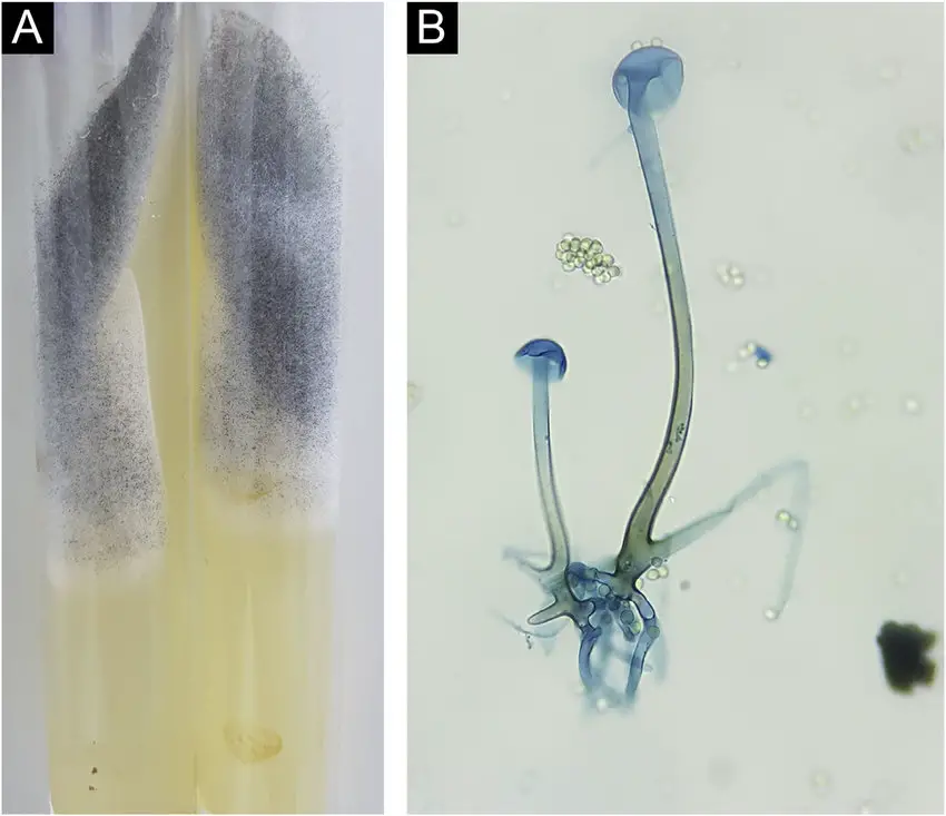 Rhizopus microsporus. (A), Colony consisting of whitish ''cotton-wool'' mycelium and blackish granular aerial mycelium. (B), Microculture showing coenocytic hypha with rhizoids, sporangiophore and empty sporangia. The presence of sporangiospores is observed around the structure (Cotton blue, ×400).
