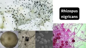 Rhizopus nigricans - Life Cycle, Repoduction, Morphology, Pathogenesis
