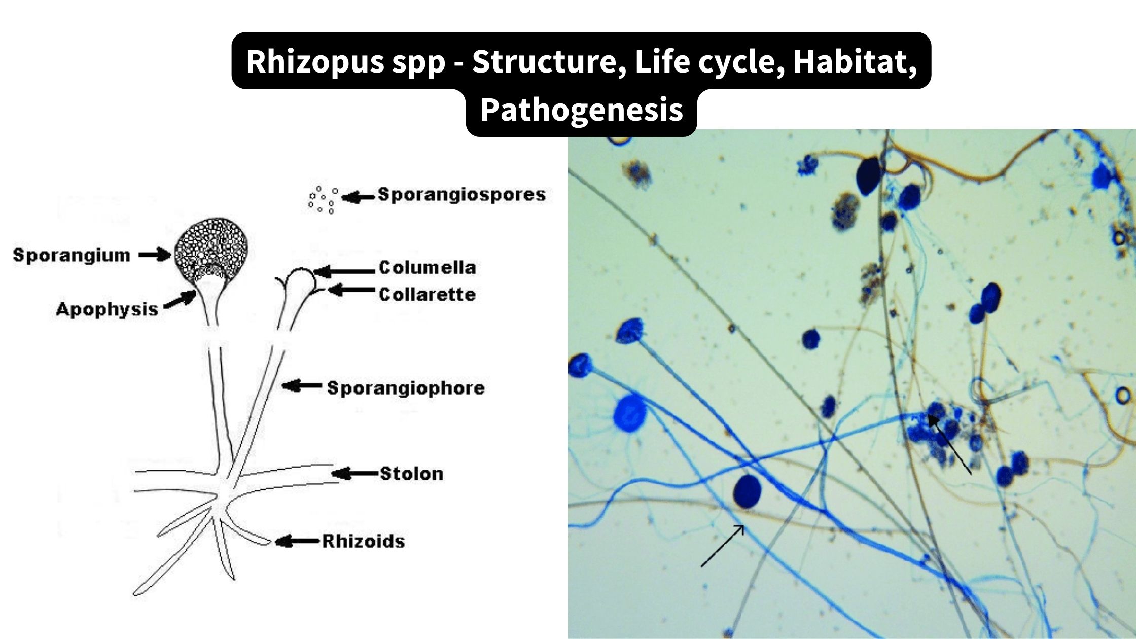 rhizopus under compound microscope
