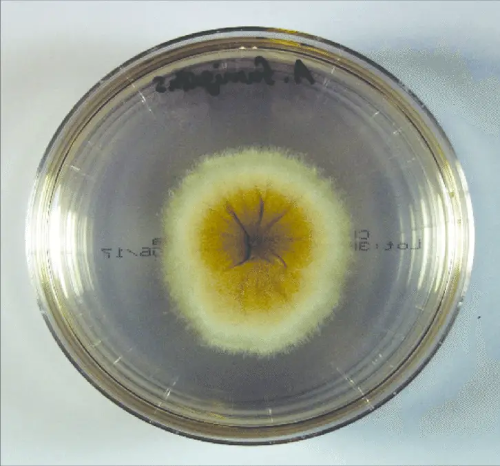 Sabouraud dextrose agar medium demonstrating growth of Aspergillus fumigatus from bronchoalveolar lavage fluid specimen. 