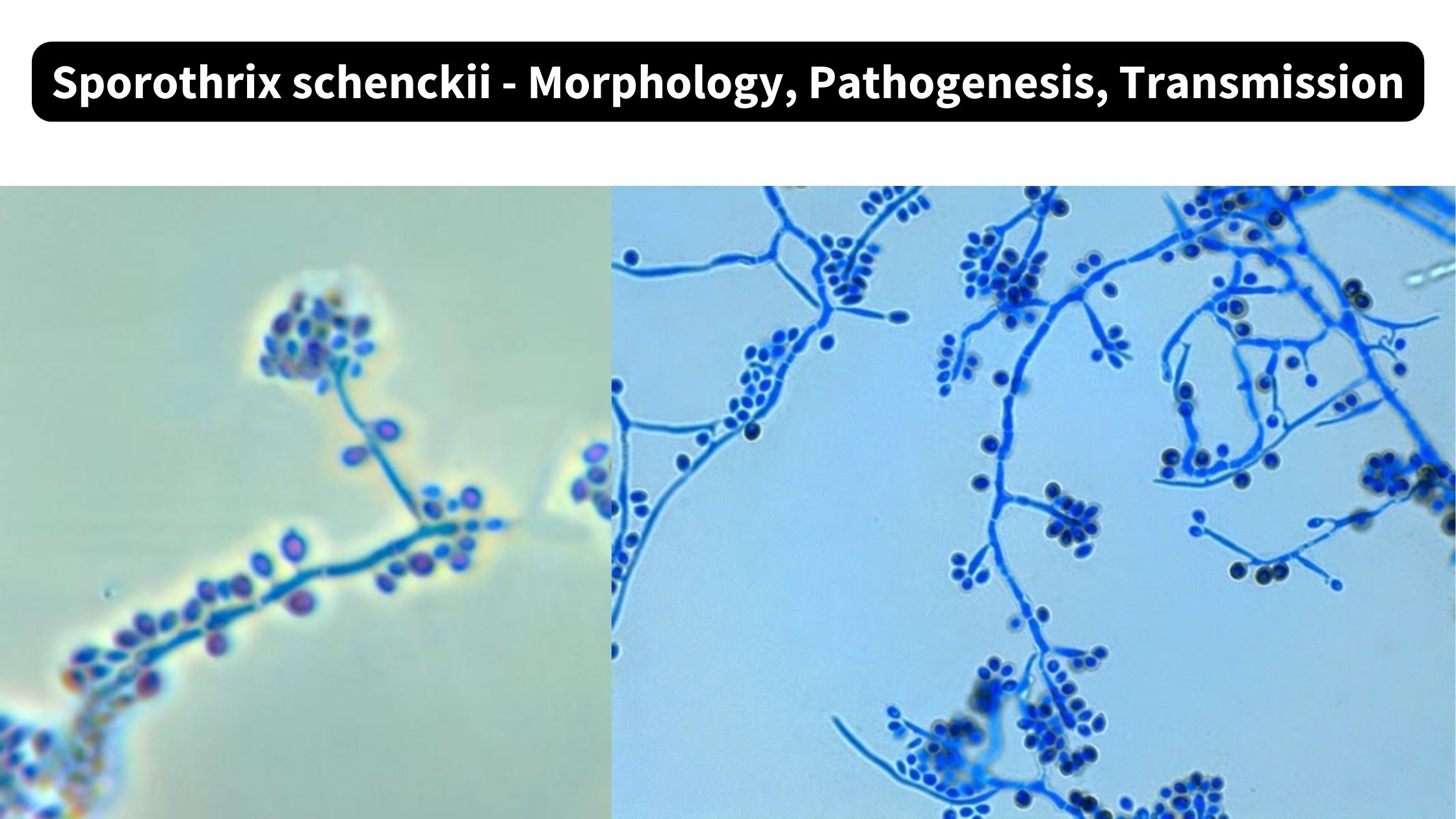 Sporothrix schenckii - Morphology, Pathogenesis, Transmission
