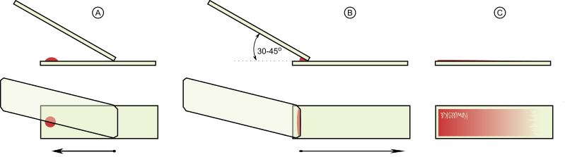 Procedure of Thin Blood Smear