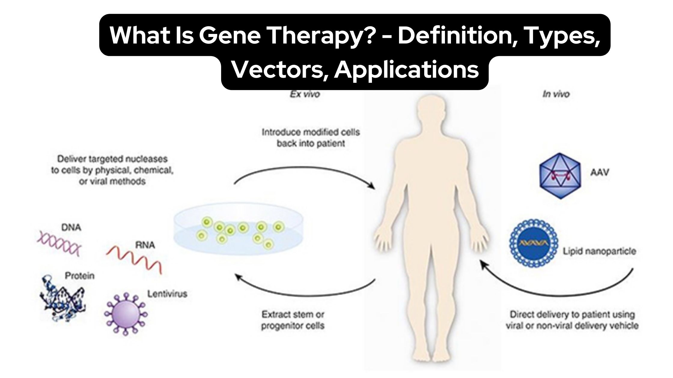 What Is Gene Therapy? - Definition, Types, Vectors, Applications