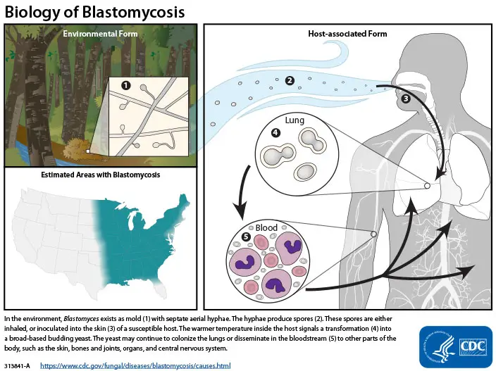 Life cycle of Blastomyces