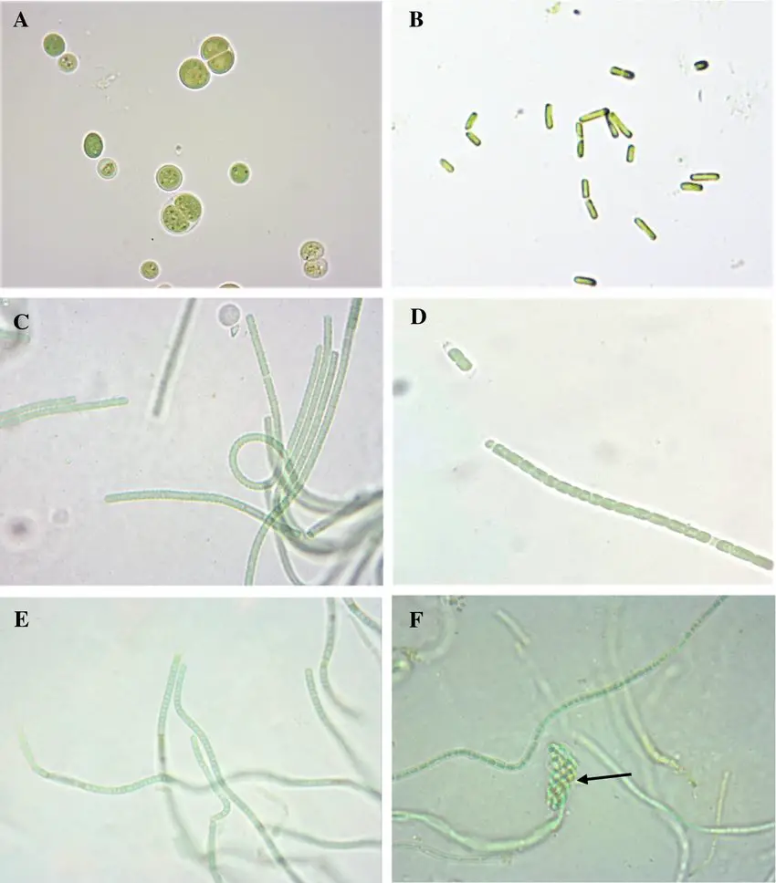 Cyanobacteria Under Microscope