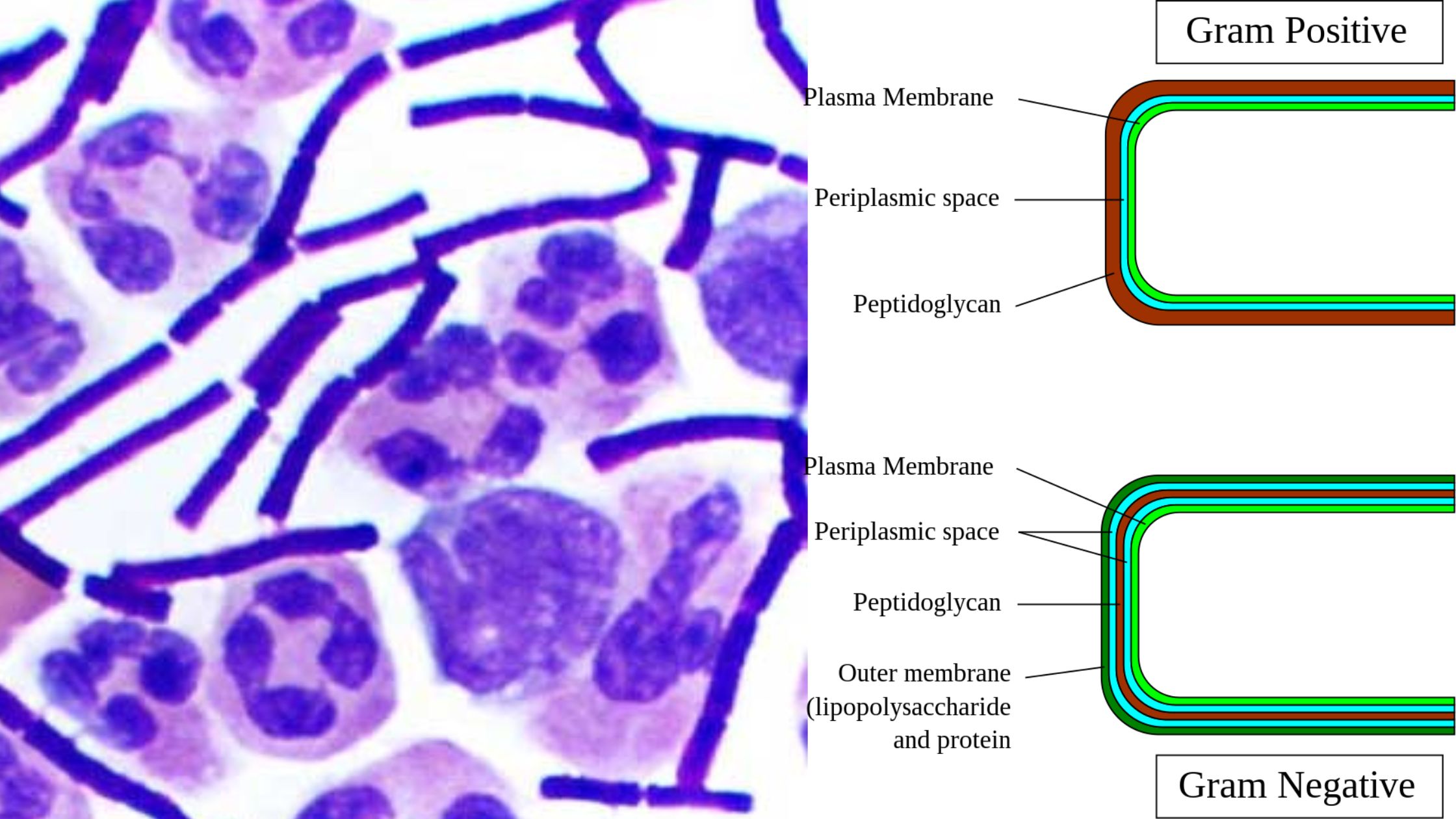 Gram Positive bacteria - Definition, Structure, Characteristics, Examples