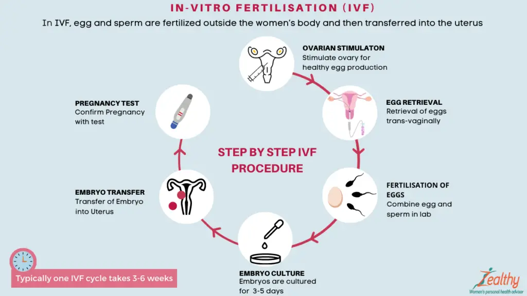 A graphic explaining the details of IVF.
