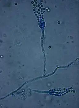Penicillium Spp. under bright field microscopy (10 x 100X) with lactophenol cotton blue stain