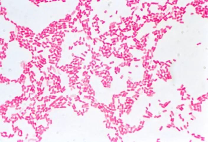 E. Coli under the Microscope 

