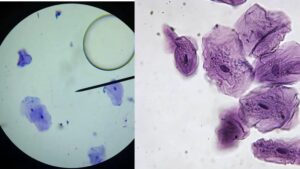 Cheek Cells Under a Microscope