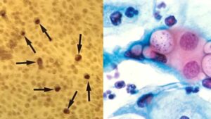 Chlamydia Under the Microscope