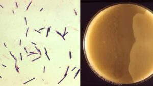 Clostridium Under Microscope