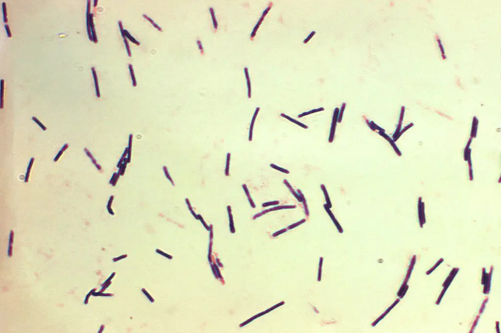Clostridium perfringens grown in Schaedler’s broth using Gram-stain