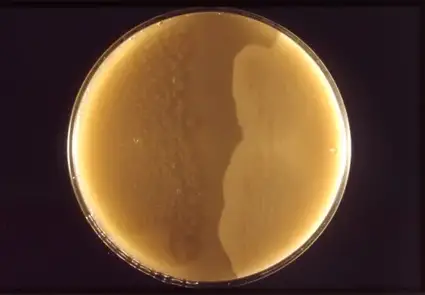 Clostridium perfringens colonies were cultured on a half-antitoxin plate