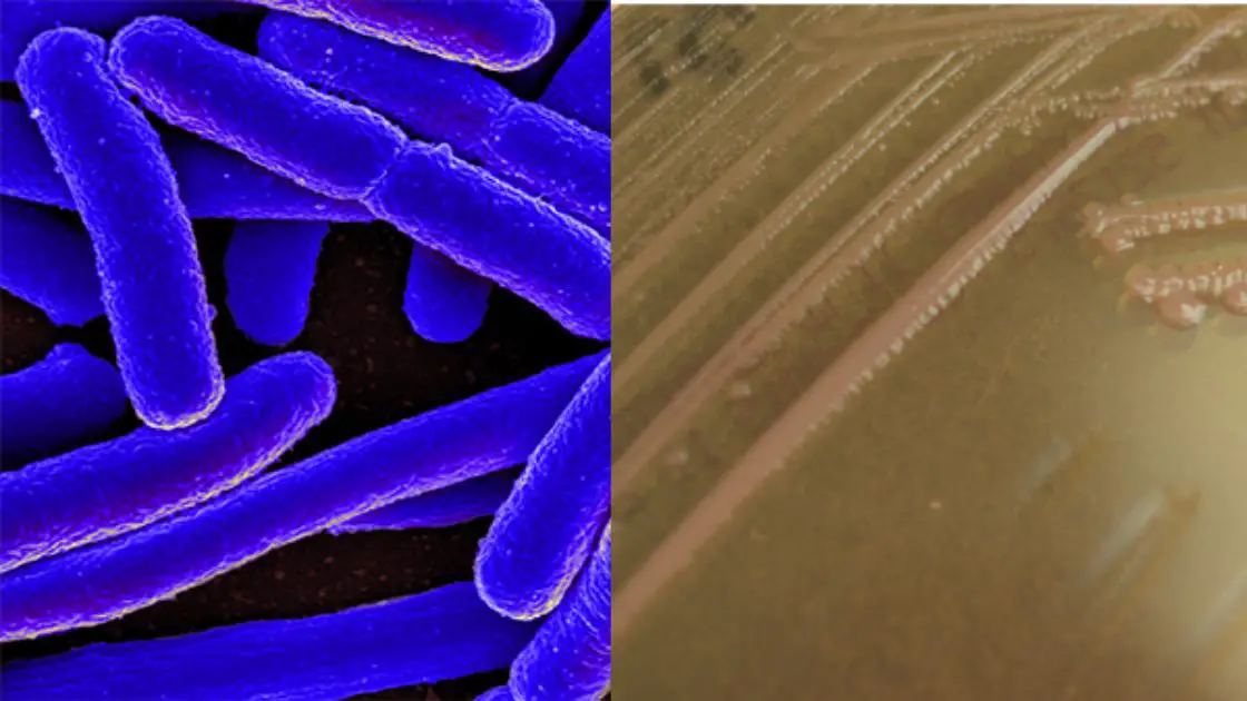 Enteroinvasive E. coli (EIEC)
