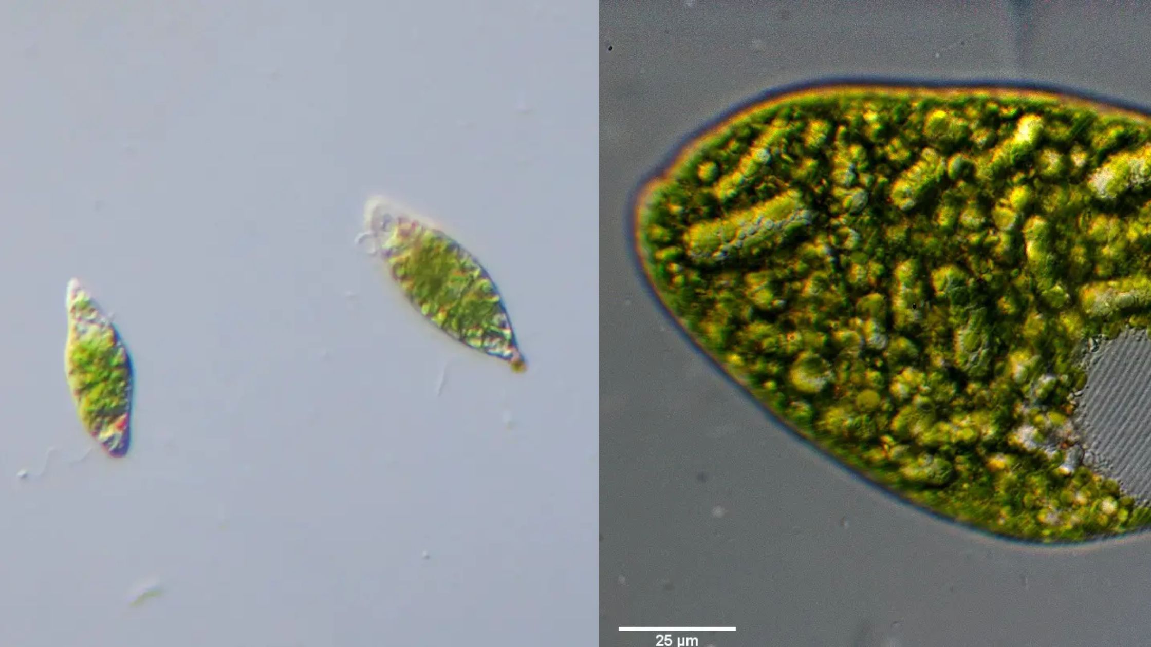 Euglena Under The Microscope