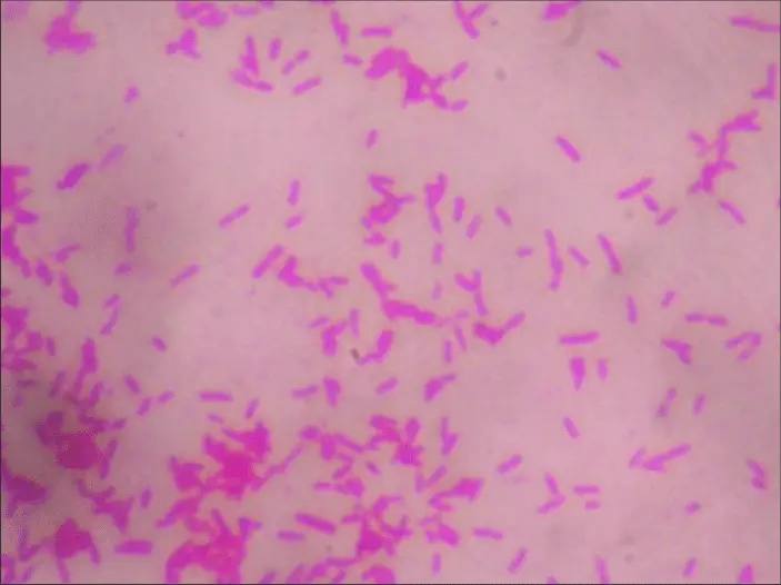 Microscopic examination result of Salmonella with negative Gram staining.

