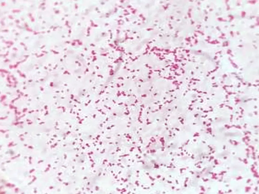 shows gram negative bacteria, of Salmonella spp. after staining by Gram stain, examination under light microscope (100X).