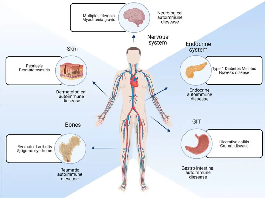 Different locations of the body that are affected by autoimmune diseases.