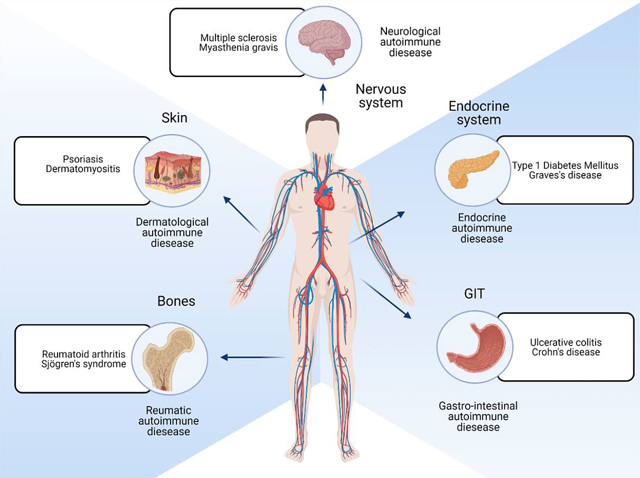 Autoimmune Disease - Definition, Types, Diagnosis, Treatment, Examples