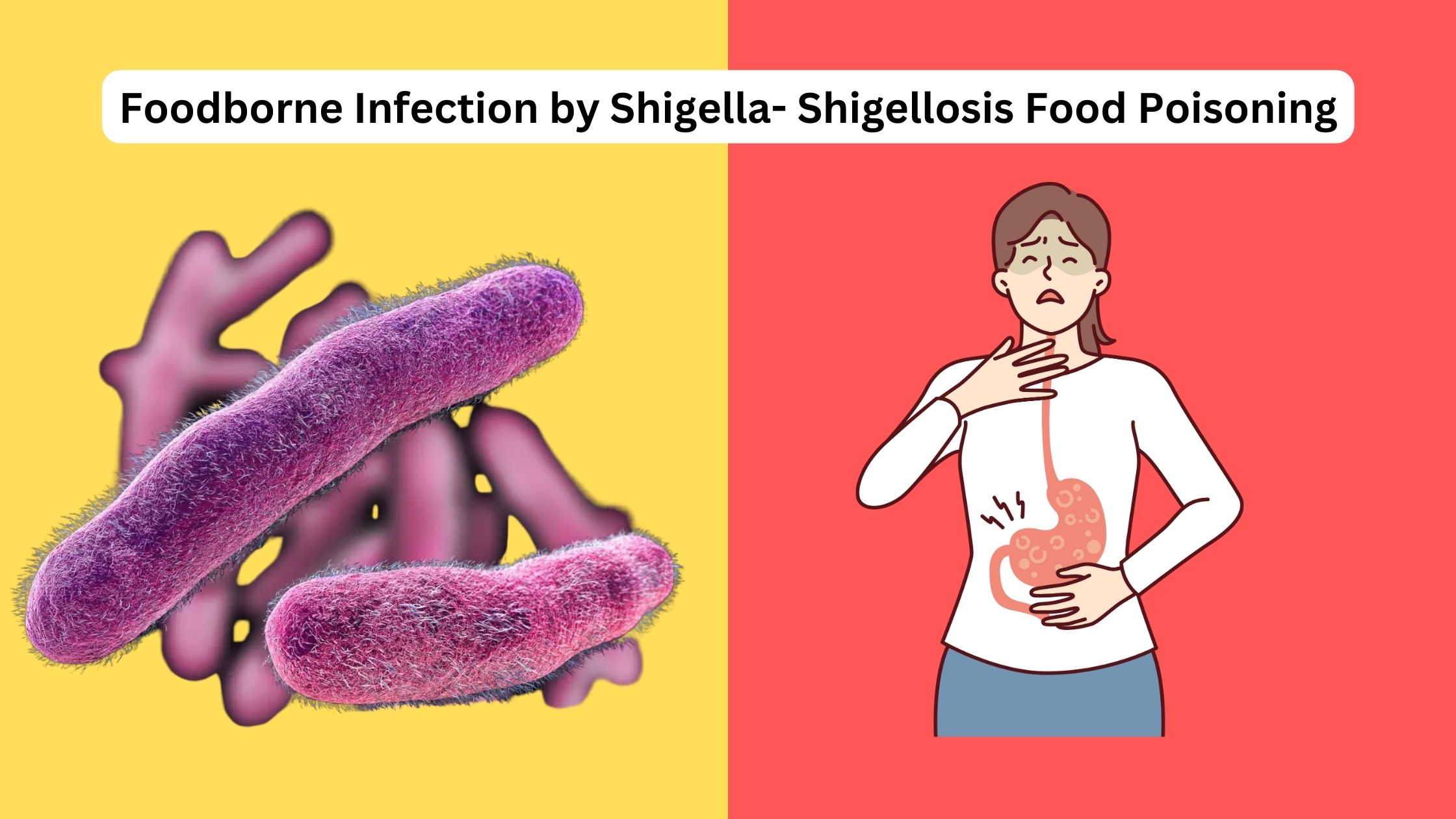 Foodborne Infection by Shigella- Shigellosis Food Poisoning