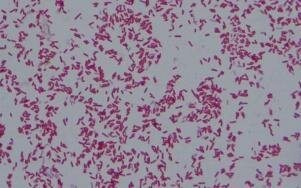 Gram negative, pink colored, small rod shape E. coli under light microscope. (100x) 
