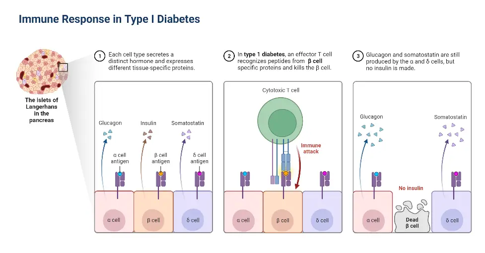 Immune Response in Type I Diabetes