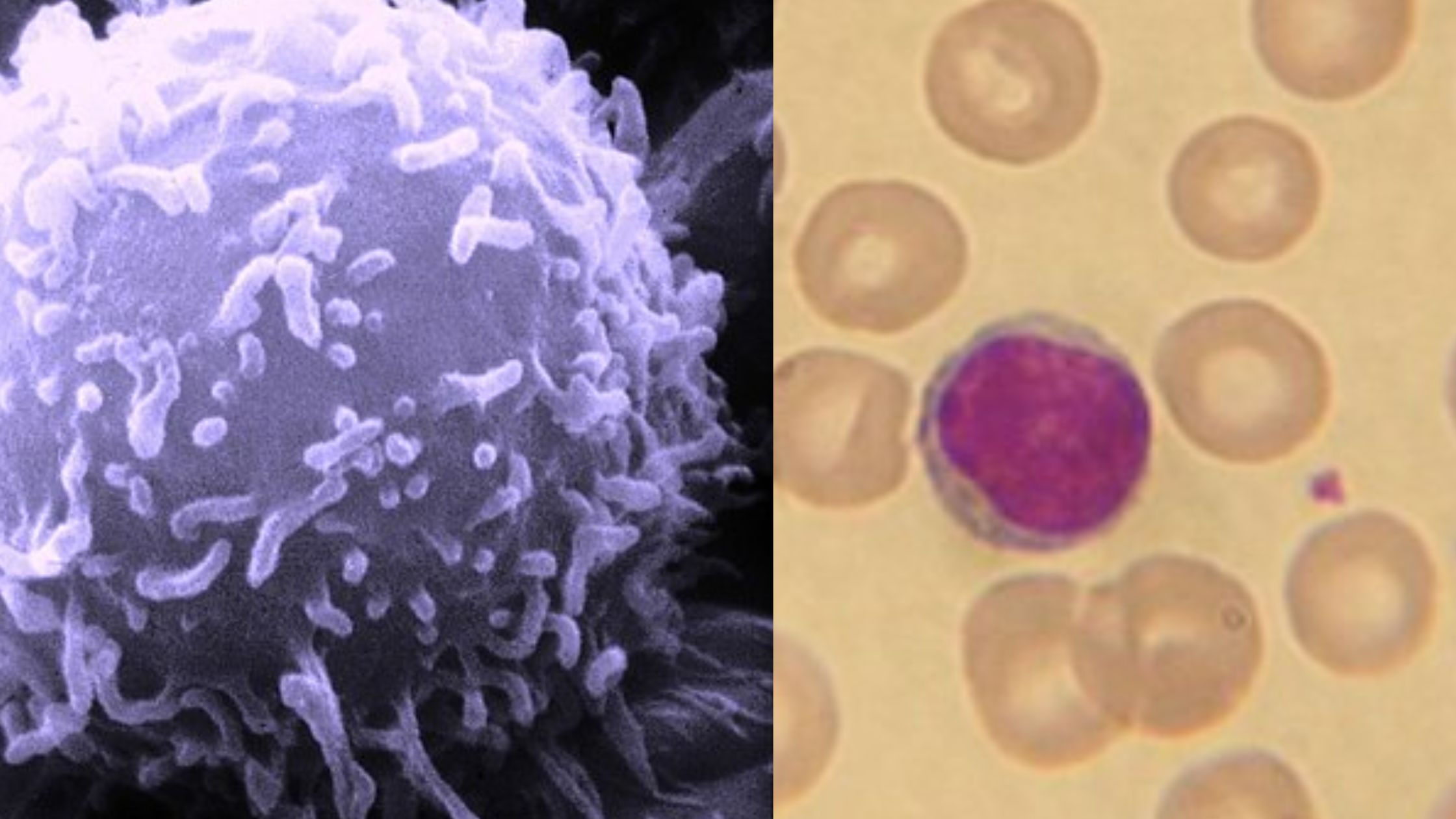 Lymphocytes - Definition, Development, Types and Functions
