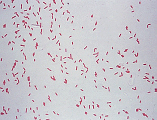 Gram stain of Pseudomonas aeruginosa cells
