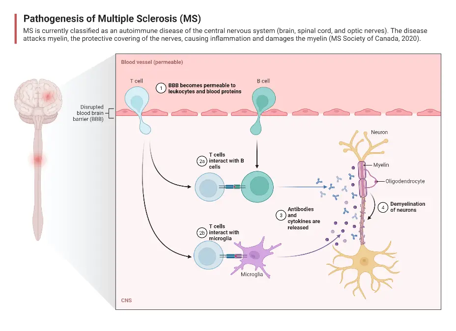 Pathogenesis of Multiple Sclerosis