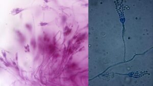 Penicillin Under a Microscope