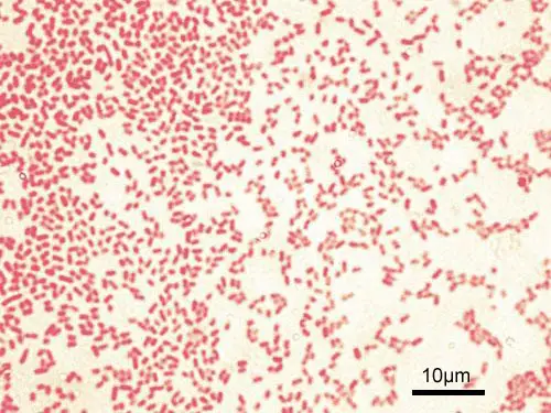 Gram-stained P. aeruginosa bacteria (pink-red rods)