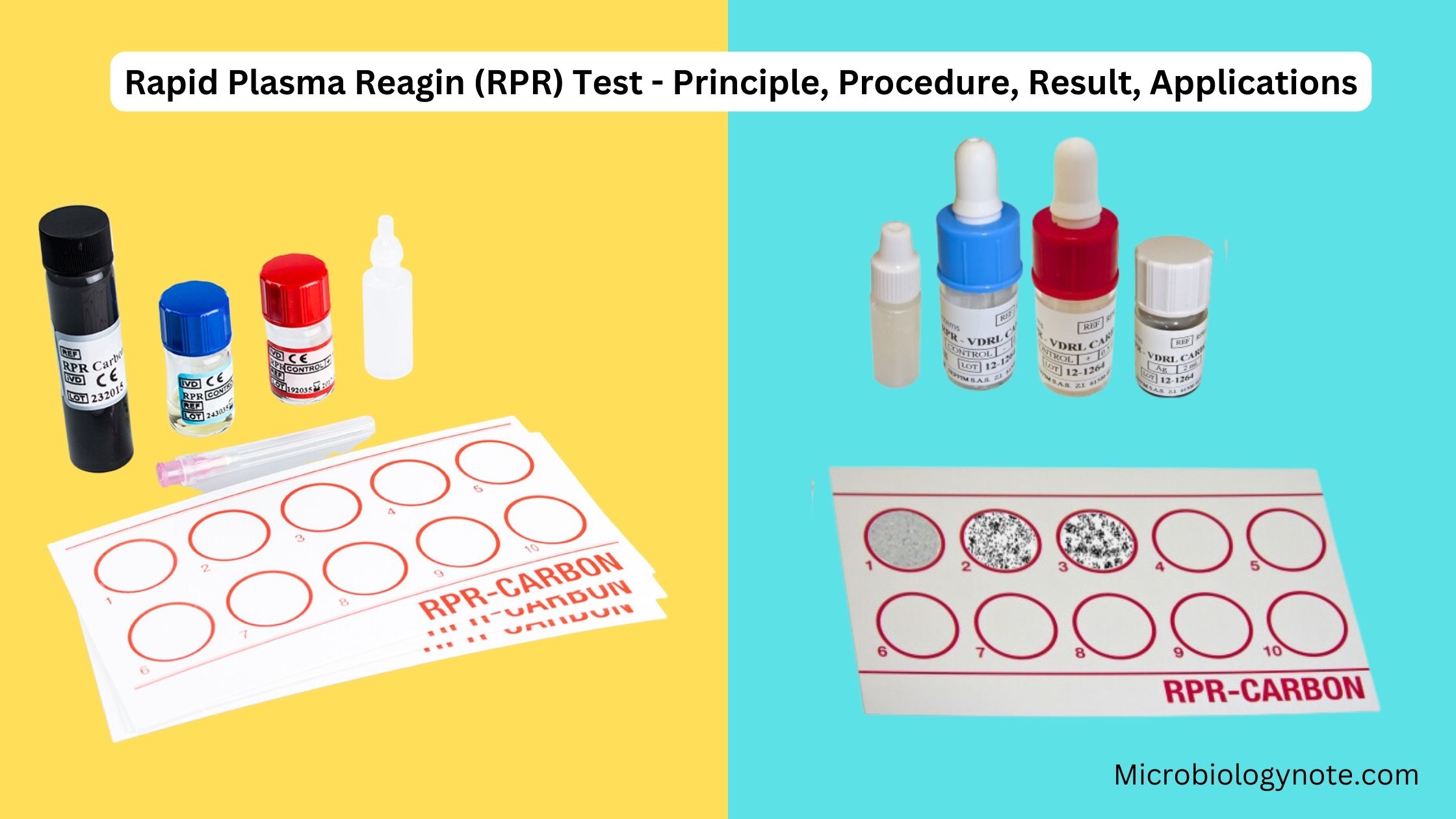 Rapid Plasma Reagin (RPR) Test - Principle, Procedure, Result, Applications