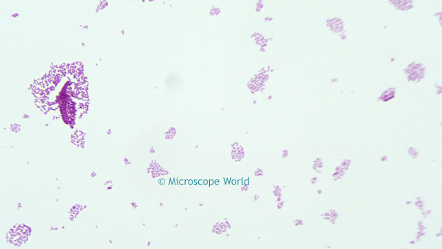 Salmonella Typhosa under the microscope at 400x.
