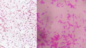 Salmonella Under Microscope