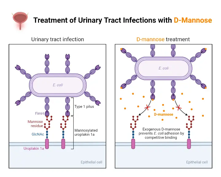 Treatment of Urinary Tract Infections with D-Mannose