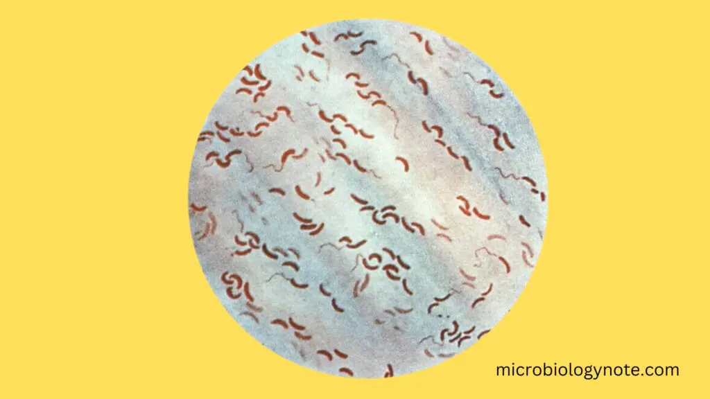 Photomicrograph of Vibrio cholerae