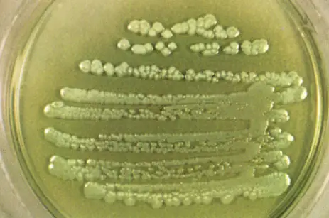 Pseudomonas aeruginosa colonies on agar
