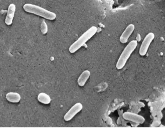 Pseudomonas aeruginosa Scanning electron micrograph. CDC
