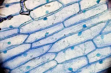 onion cells stained with Methylene Blue
